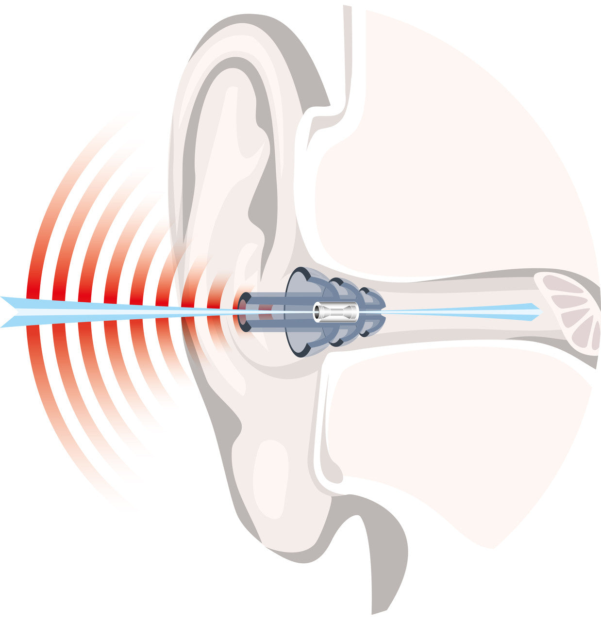 Auritech Hearing Protectors